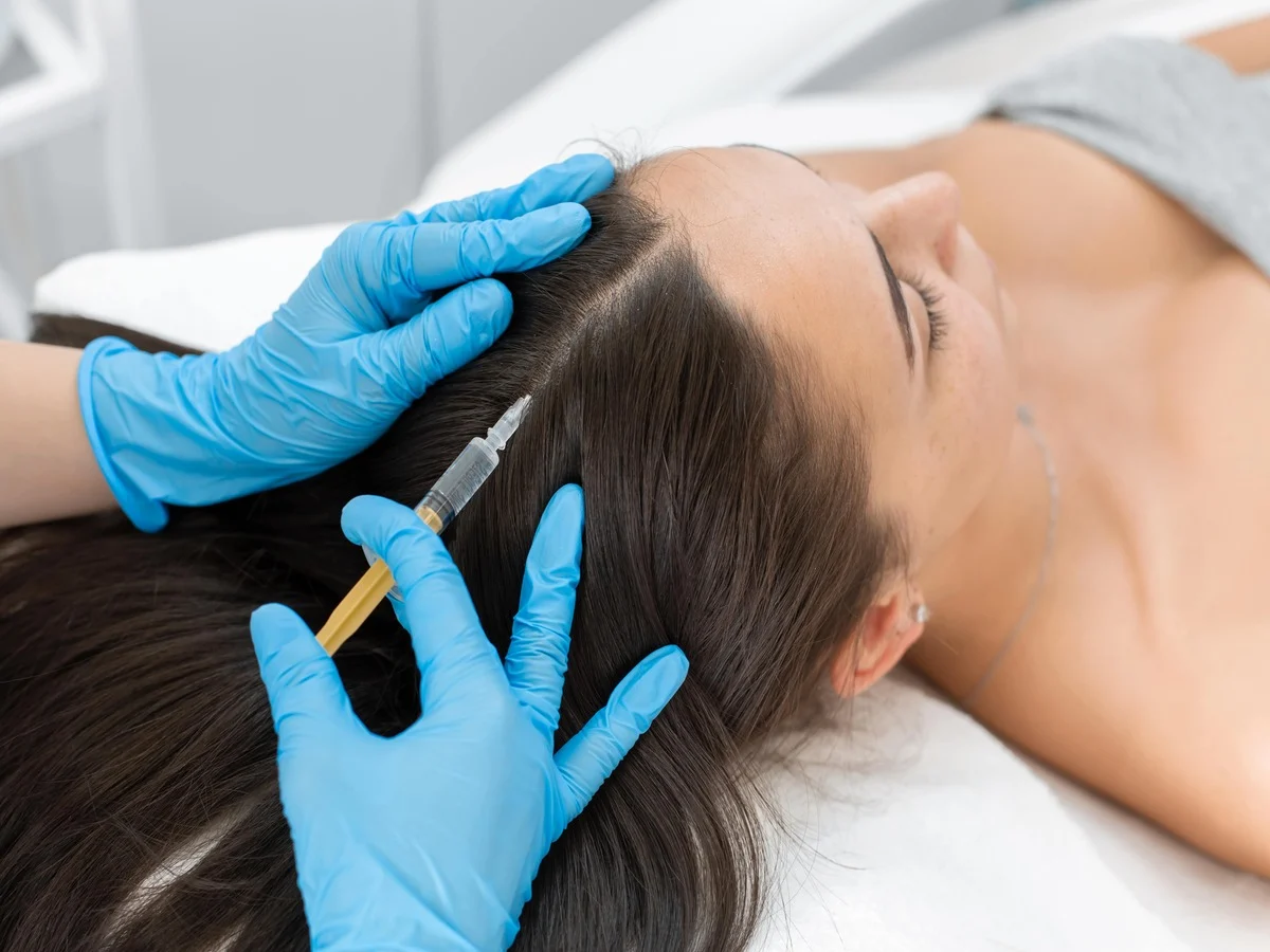 PRP hair restoration therapy at Skin Artistry Clinic Alamo CA