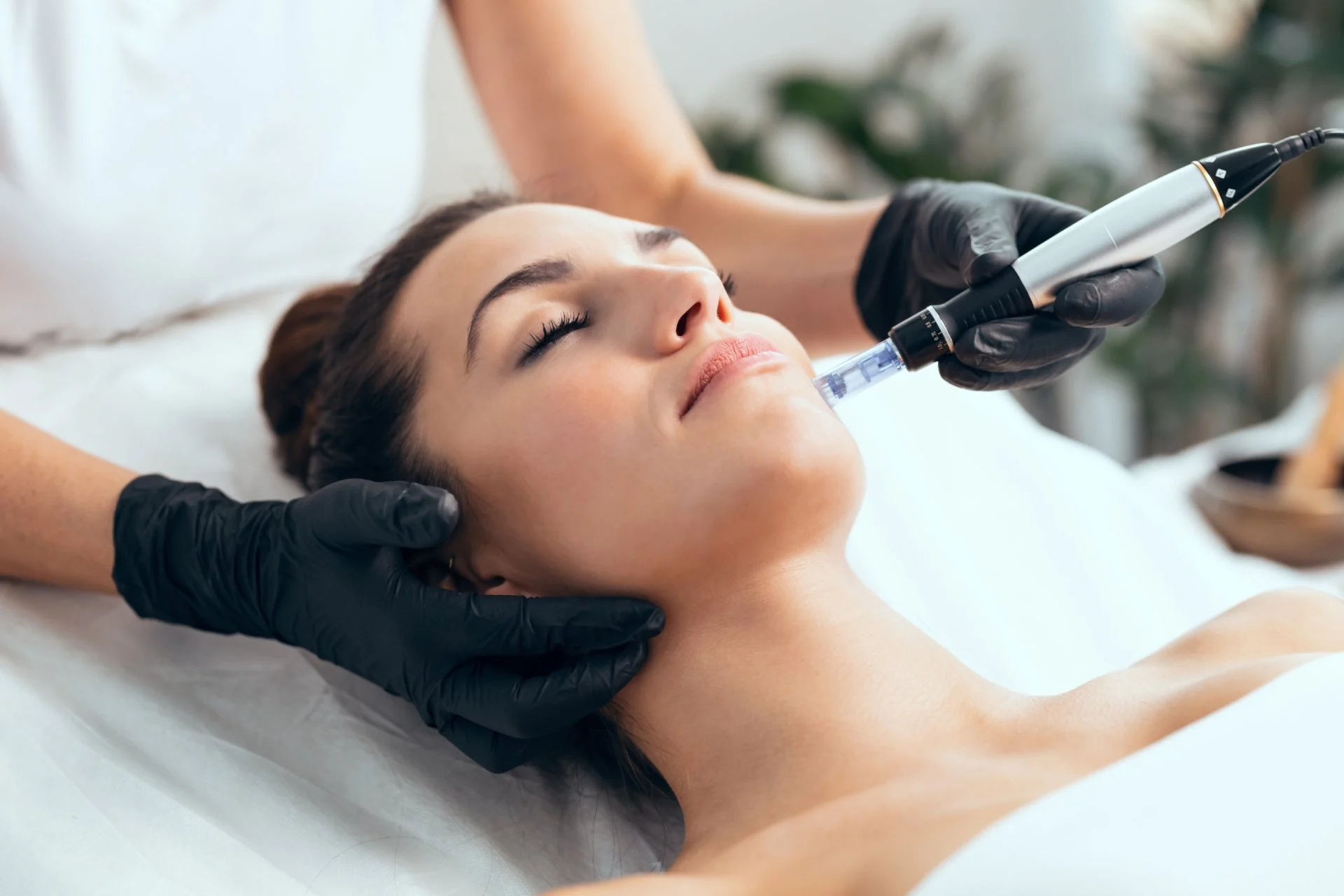 PRP Vampire Facial Treatment In Alamo CA