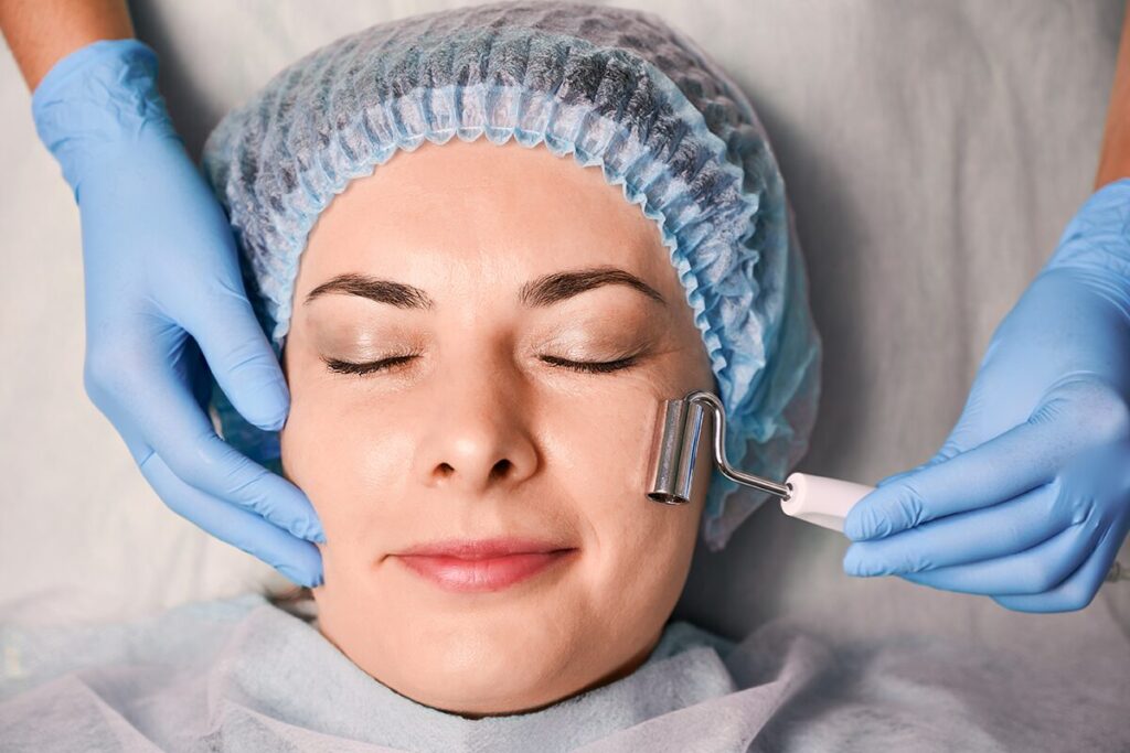 Who can get Microneedling?