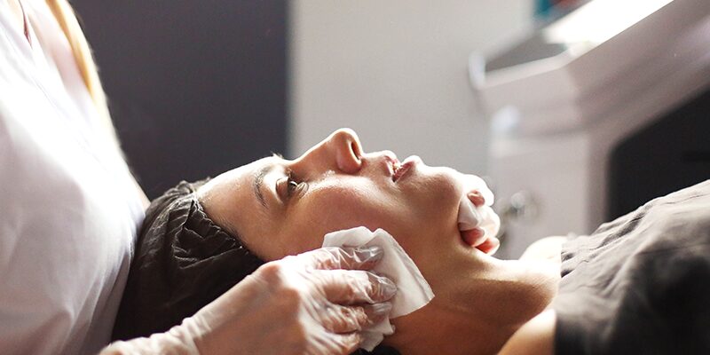 Medical-grade Peels in Danville, CA