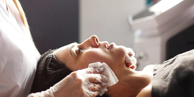 Medical-grade Peels in Danville, CA