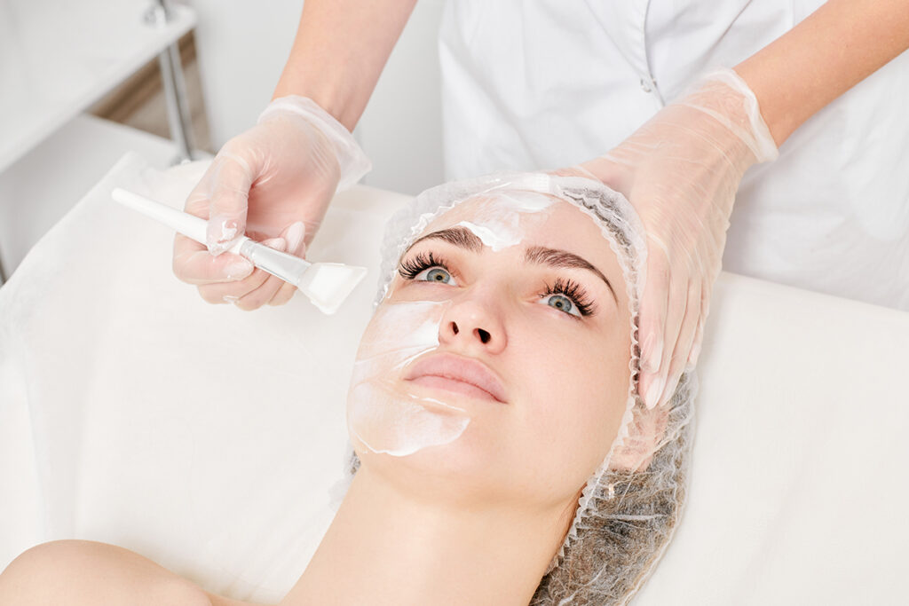 Is chemical peeling good for your skin?