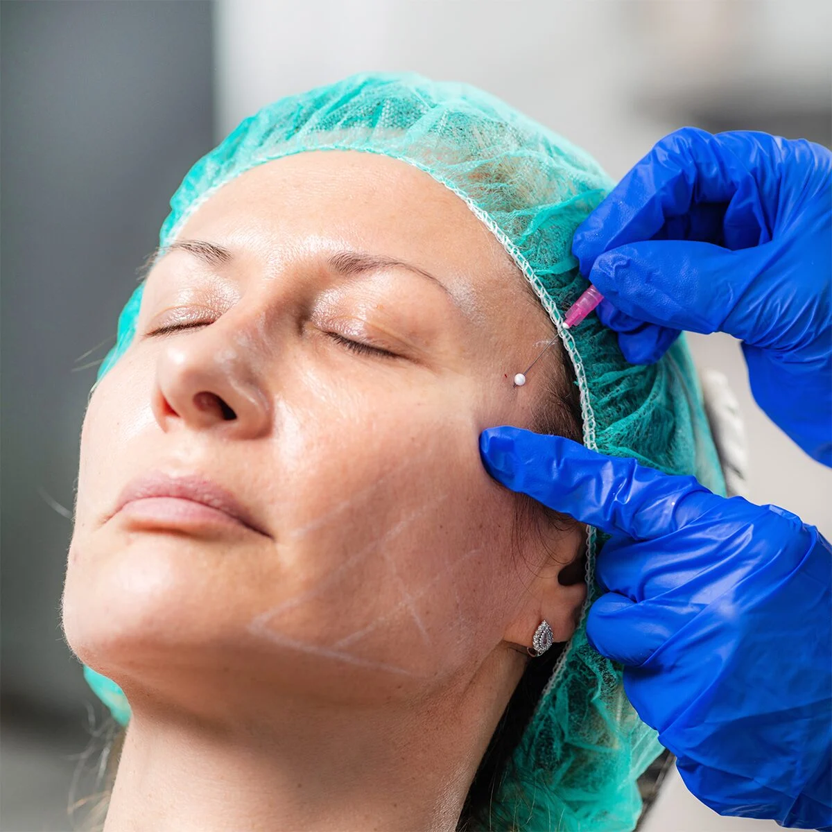 Looking for Skinviva in Your Area?