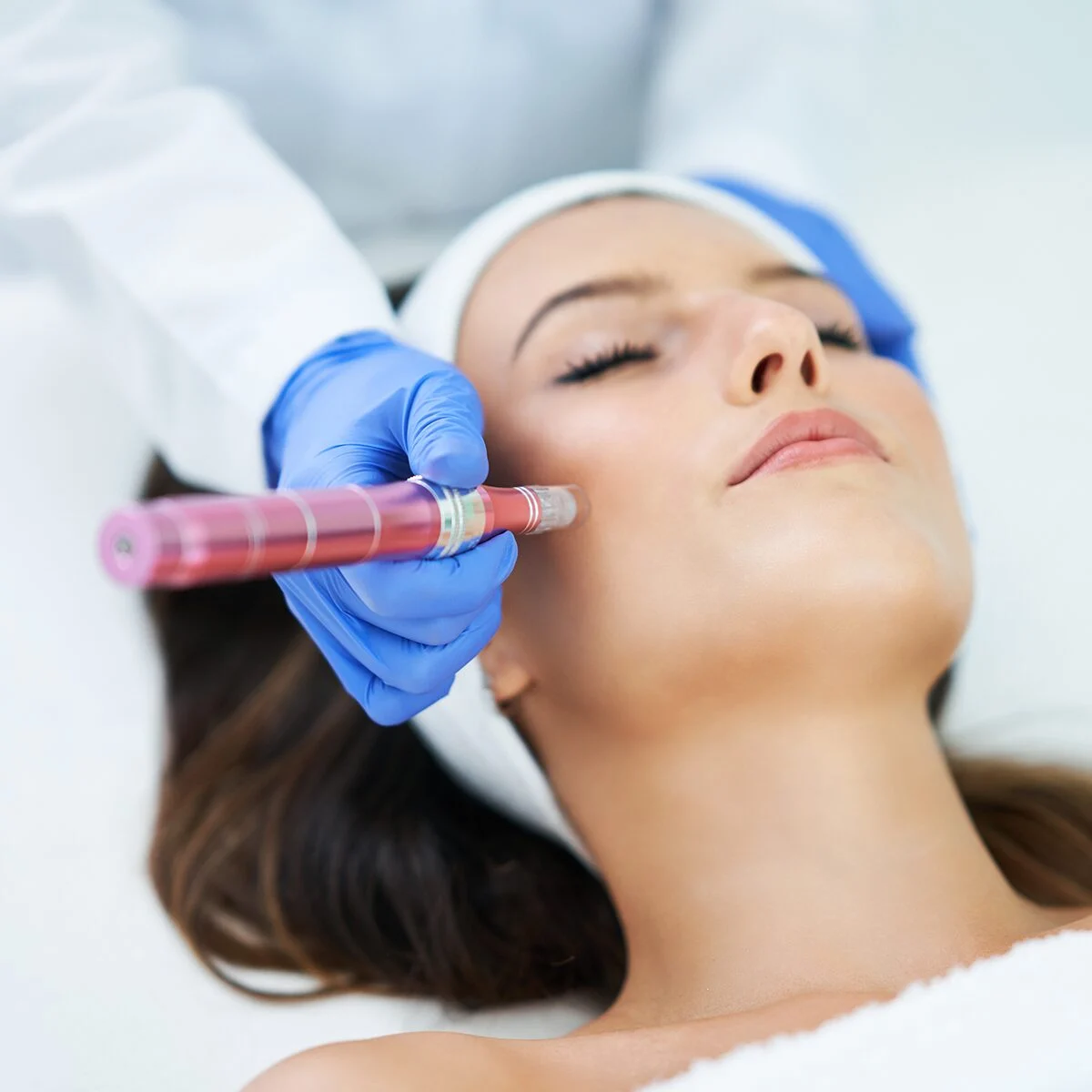 What is another name for a vampire facial?