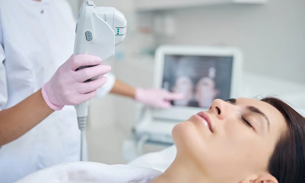 How long do IPL photofacial results last?