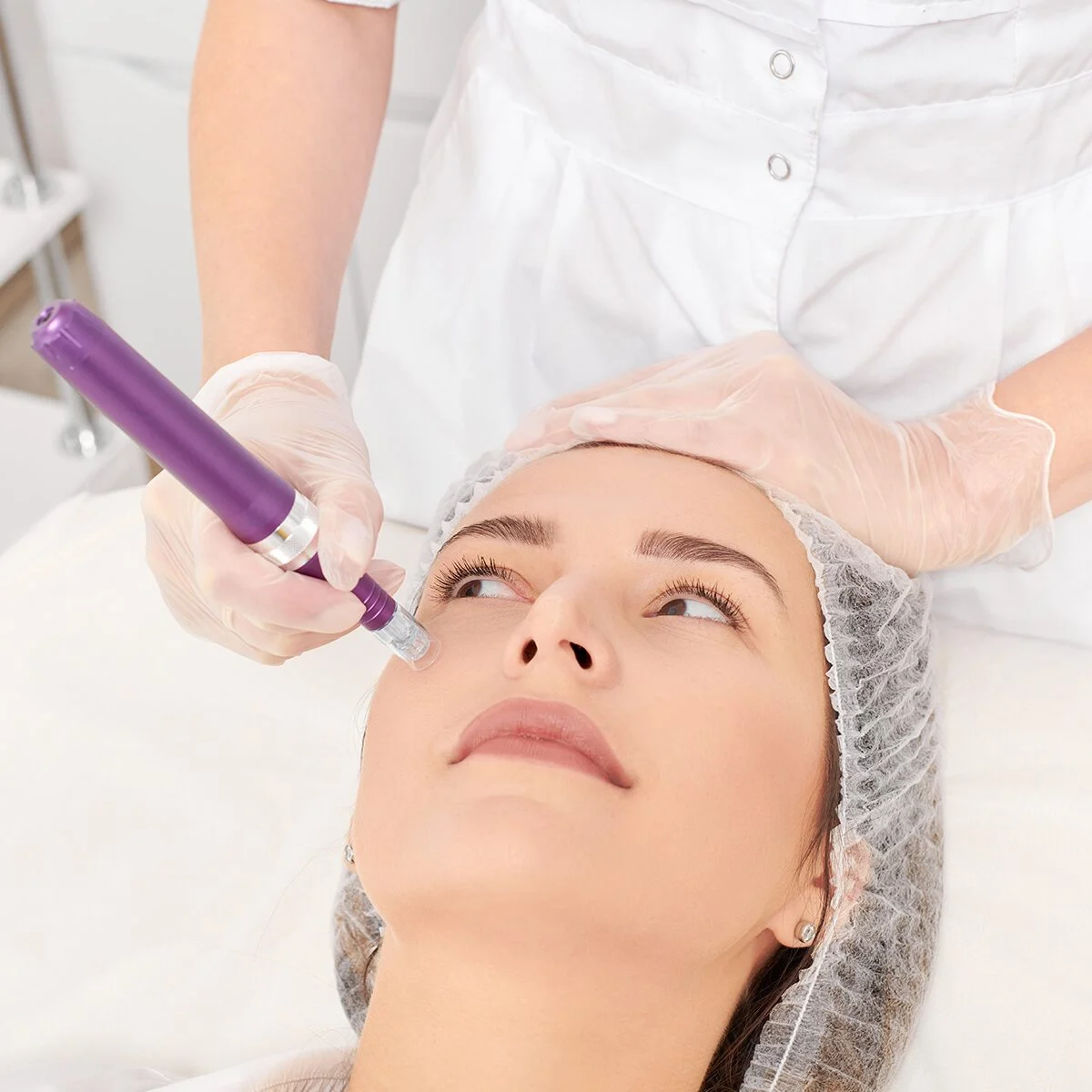 What type of facial is microneedling?