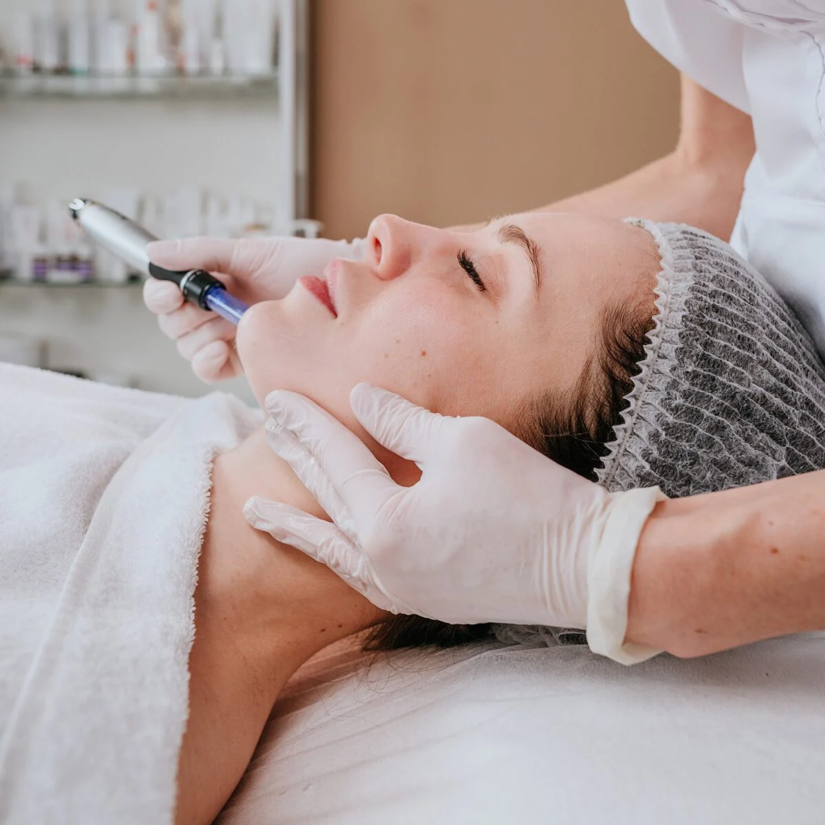 What are the downsides of microneedling with PRP?