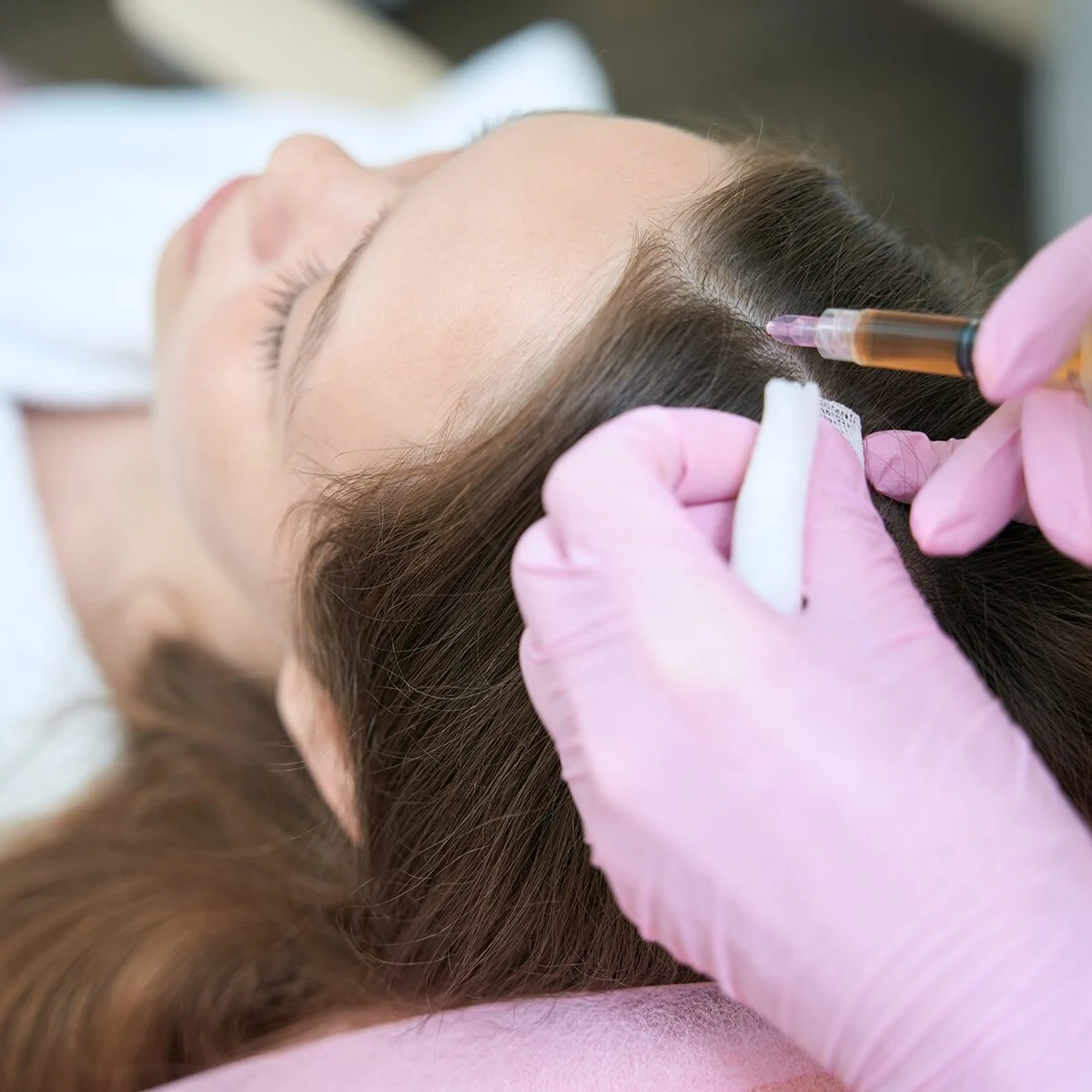 PRP Therapy by Skin Artistry Clinic
