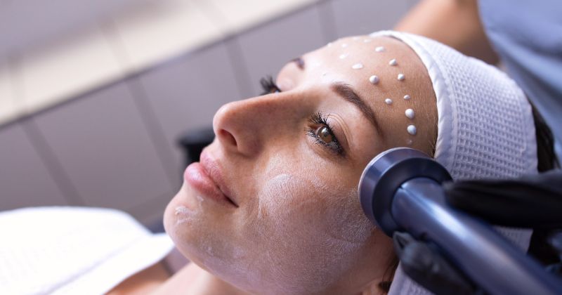 Concord California Microneedling Clinic