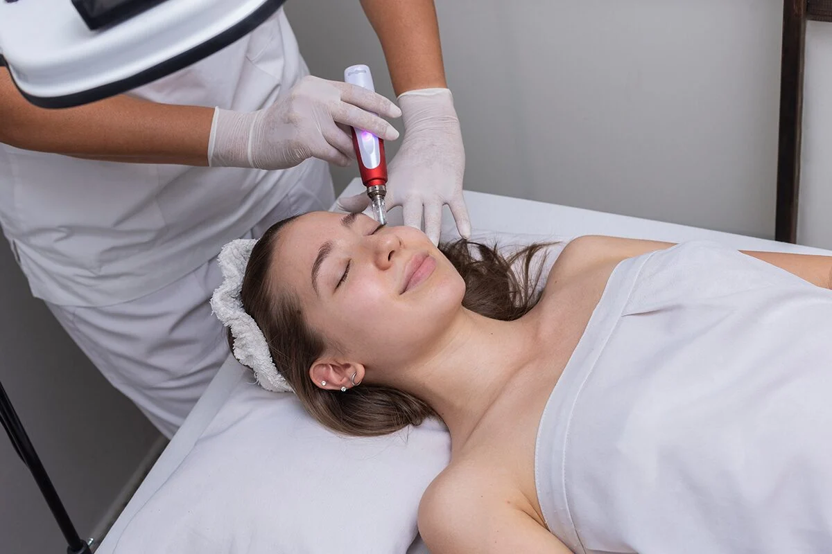 Does Microneedling Speed Up Aging