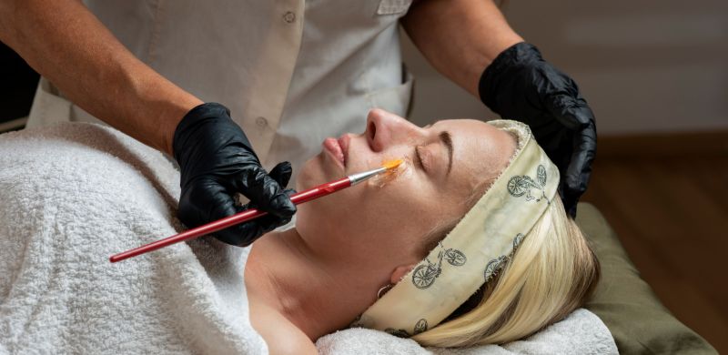 Medical-grade Peels in Concord, CA