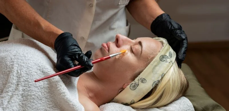 Medical-grade Peels in Concord, CA