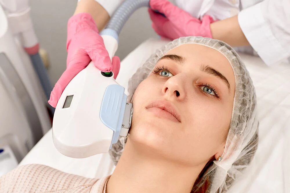IPL treatment for skin tightening