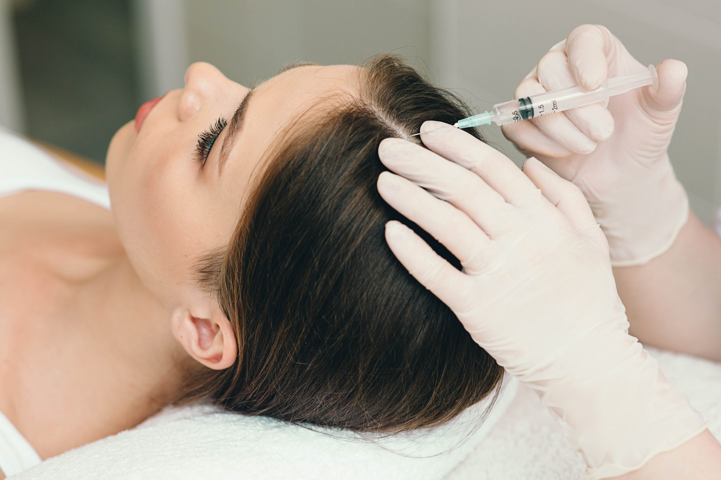 Microneedling with PRP