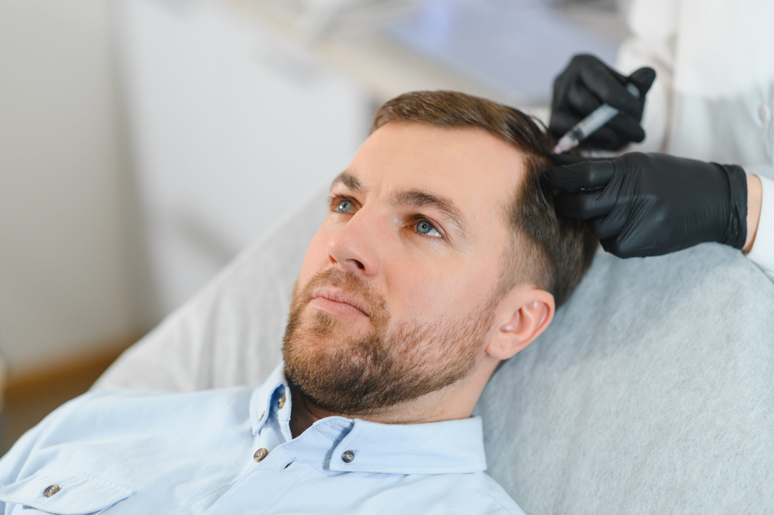 Side Effects of Minoxidil