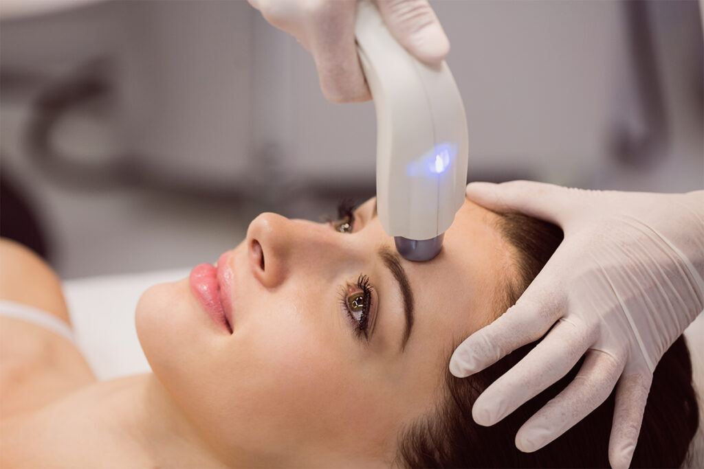 Does IPL really remove hair permanently?