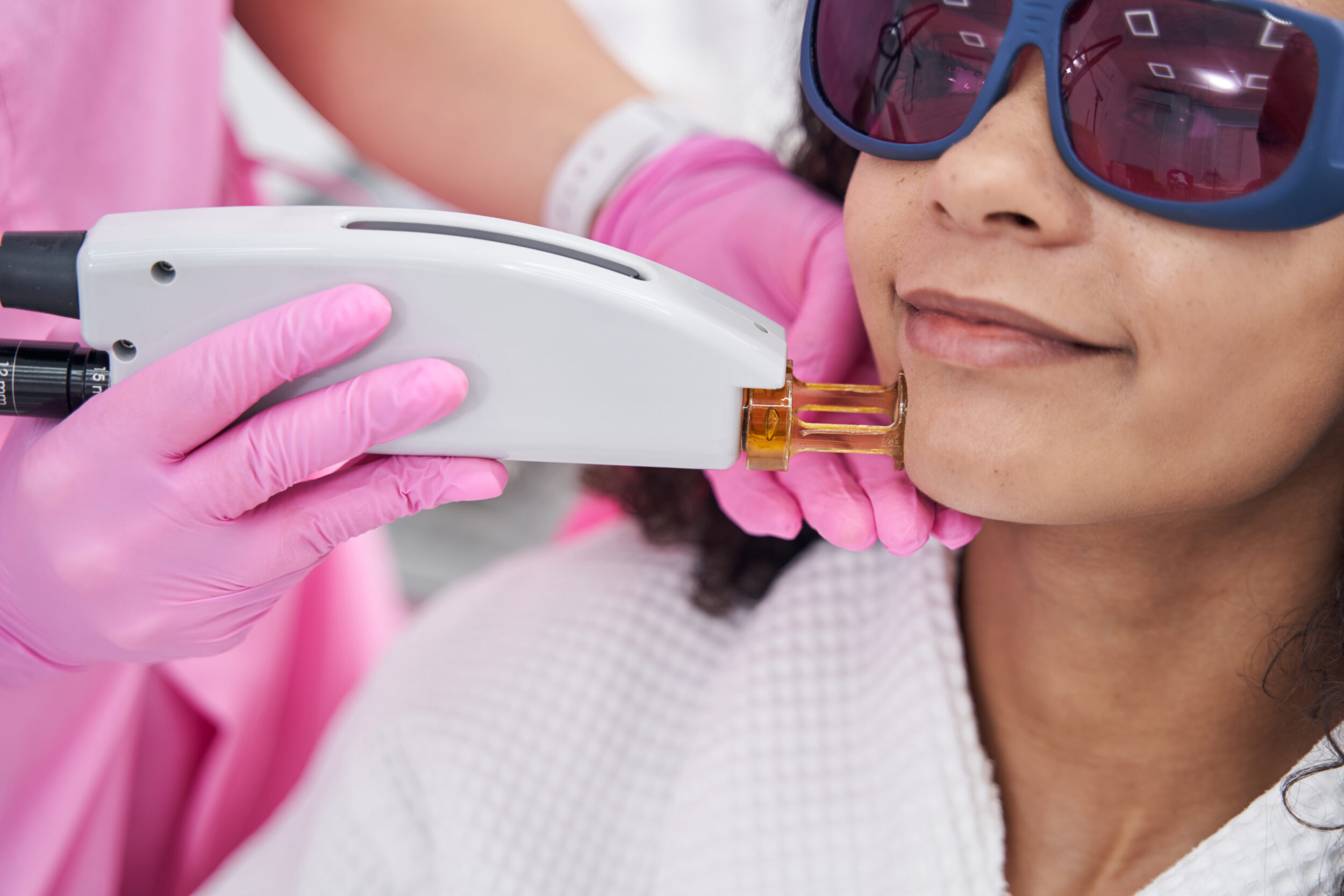 Is IPL Hair Removal Permanent or Not?