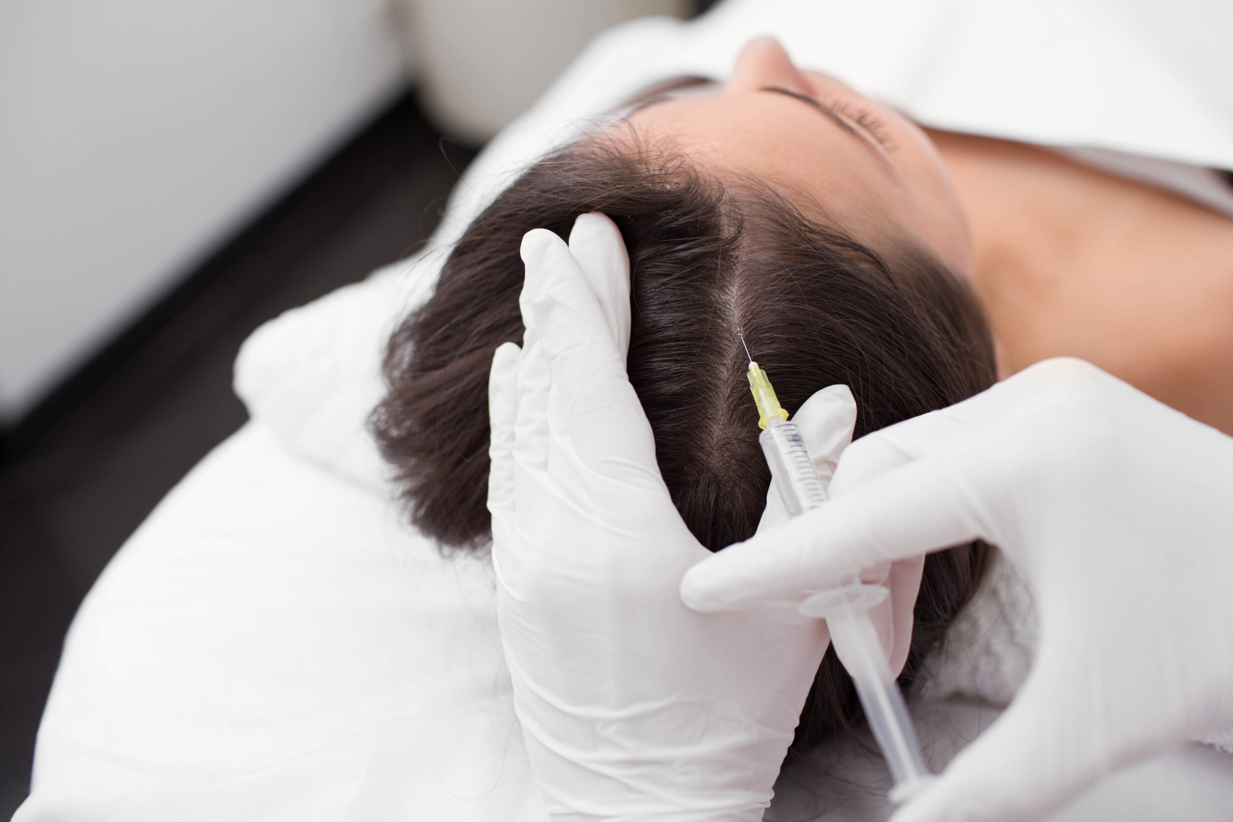 What to Expect From PRP Hair Restoration