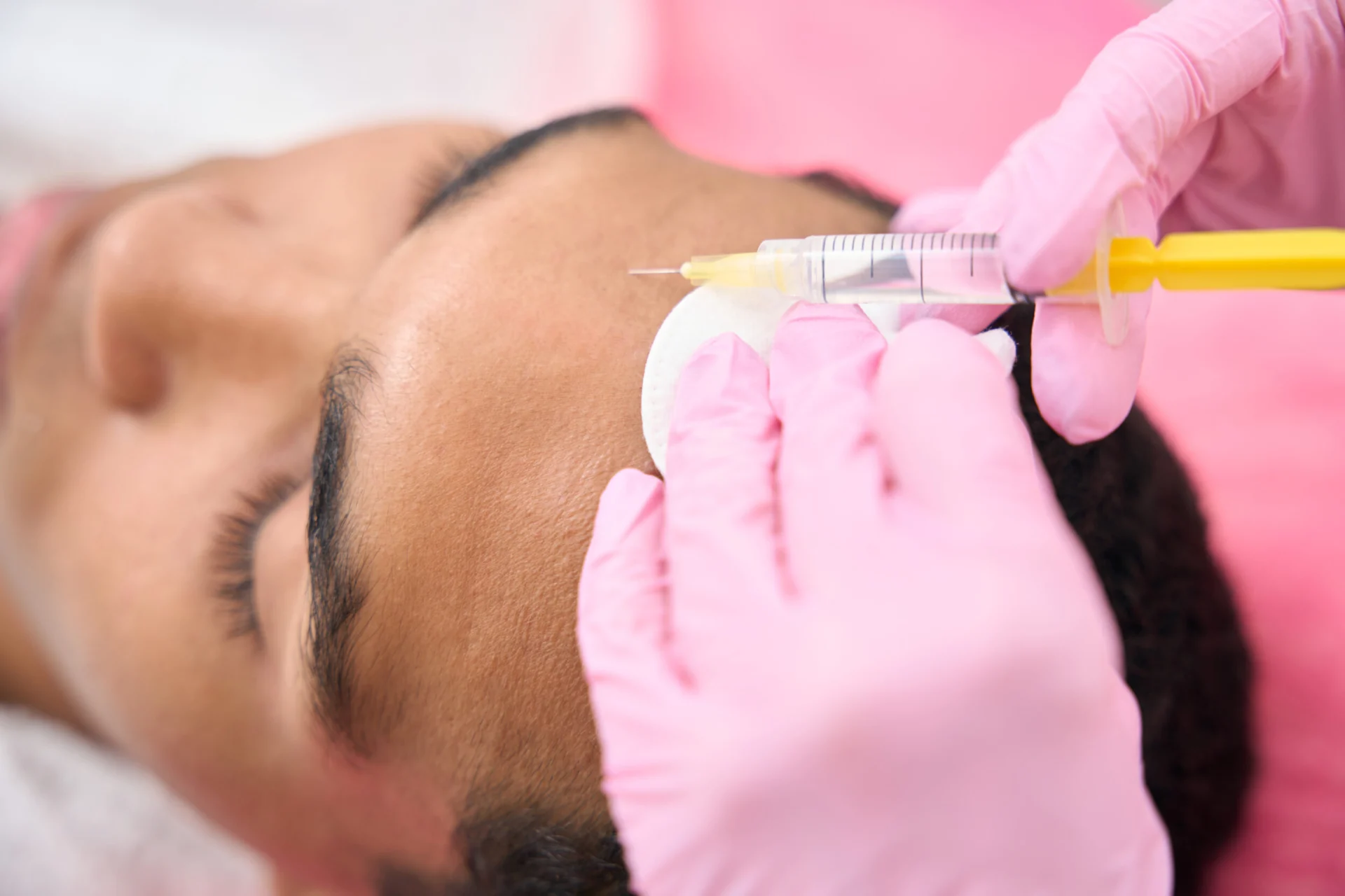 The Healing Process of Microneedling With PRP