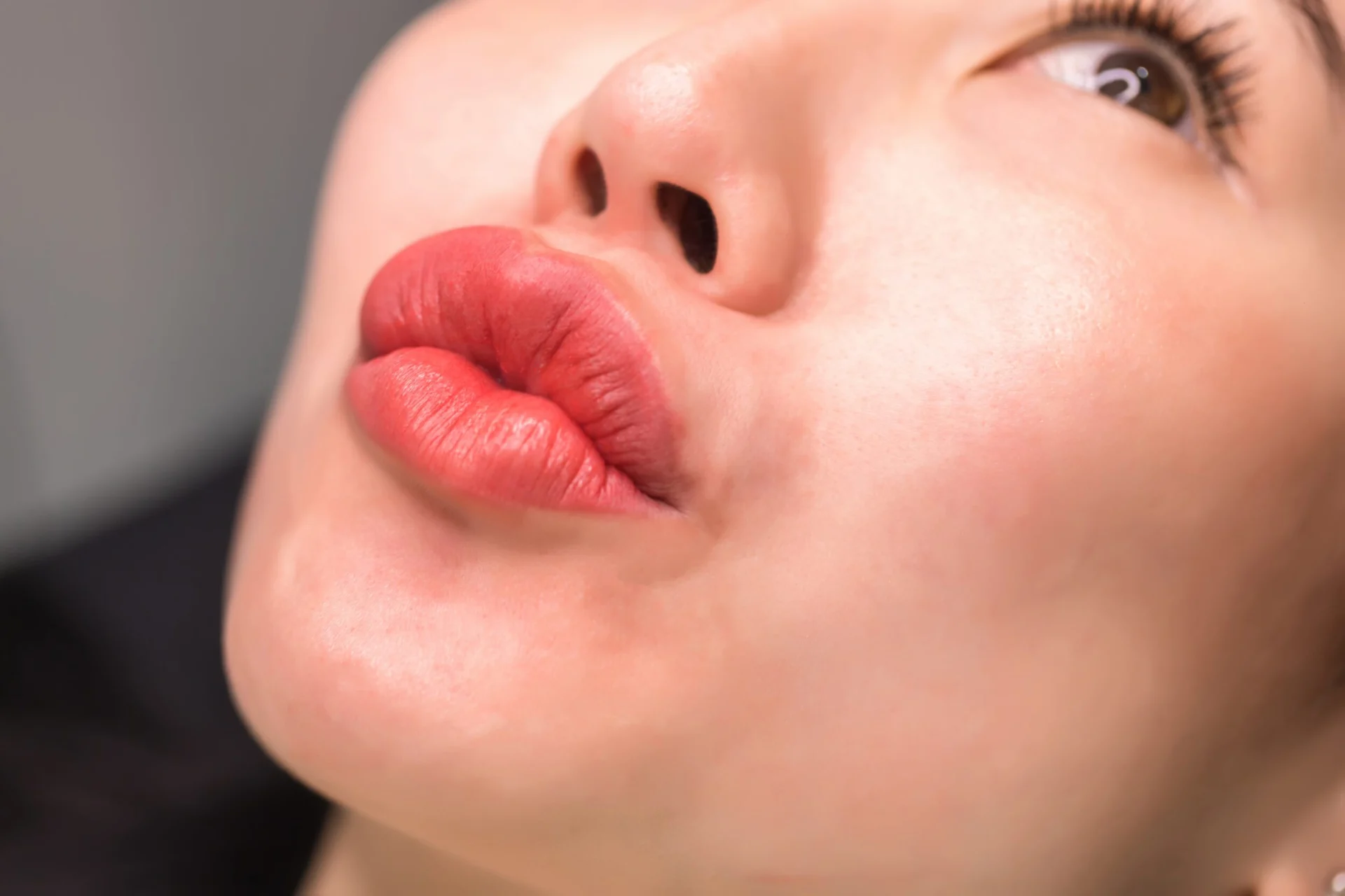 Non-Surgical Volume Restoration In Alamo California