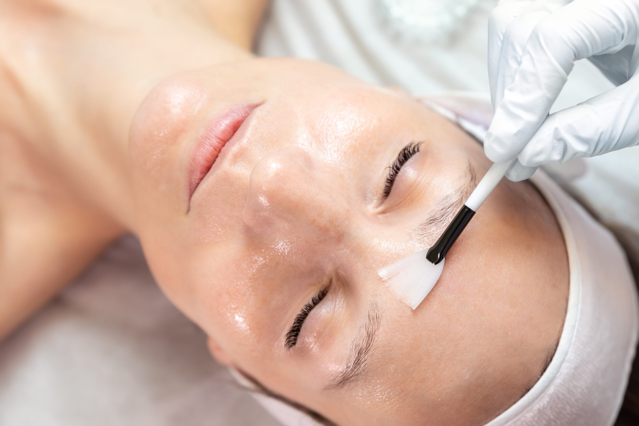 Anti-Aging Chemical Peel Procedure Cost Alamo CA