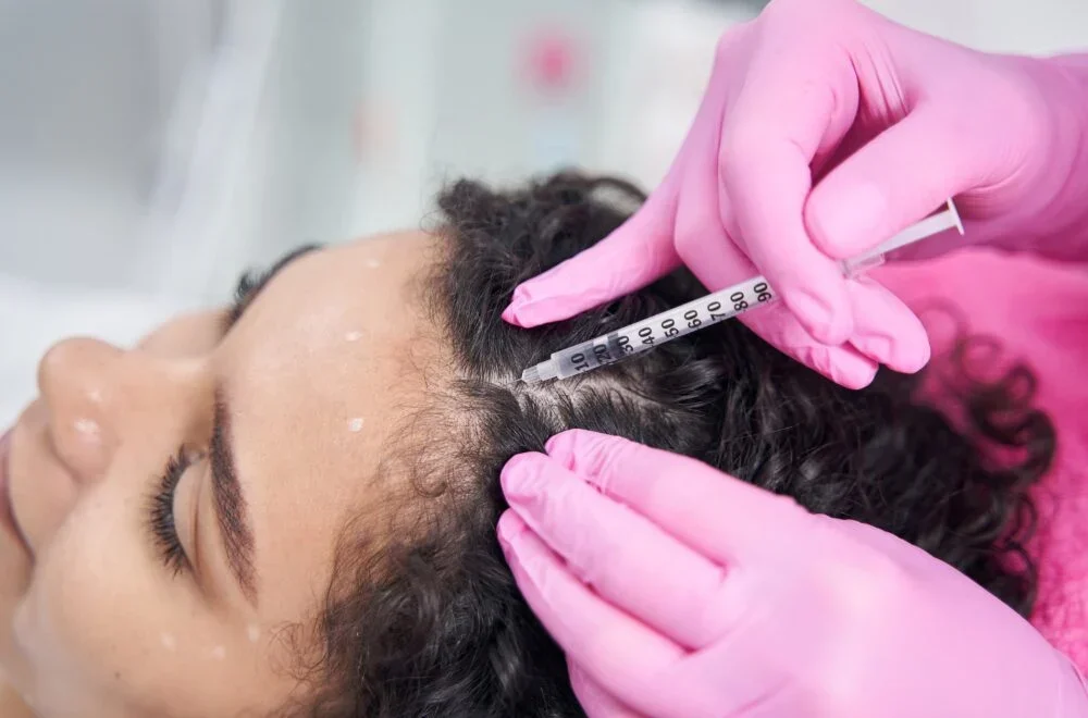 PRP Hair Treatment for Lasting Results
