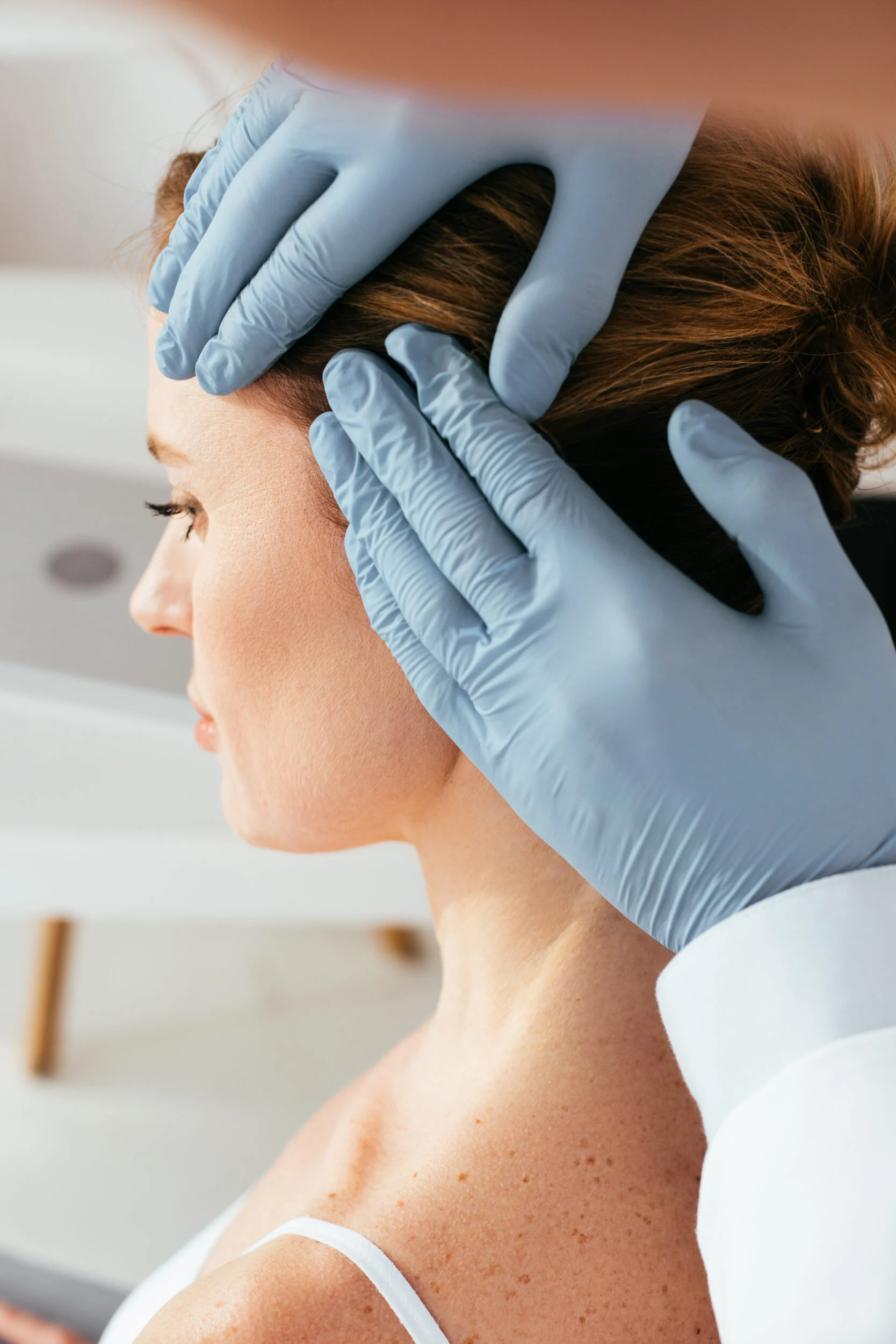 PRP Scalp Treatment For Hair Regrowth In Alamo CA