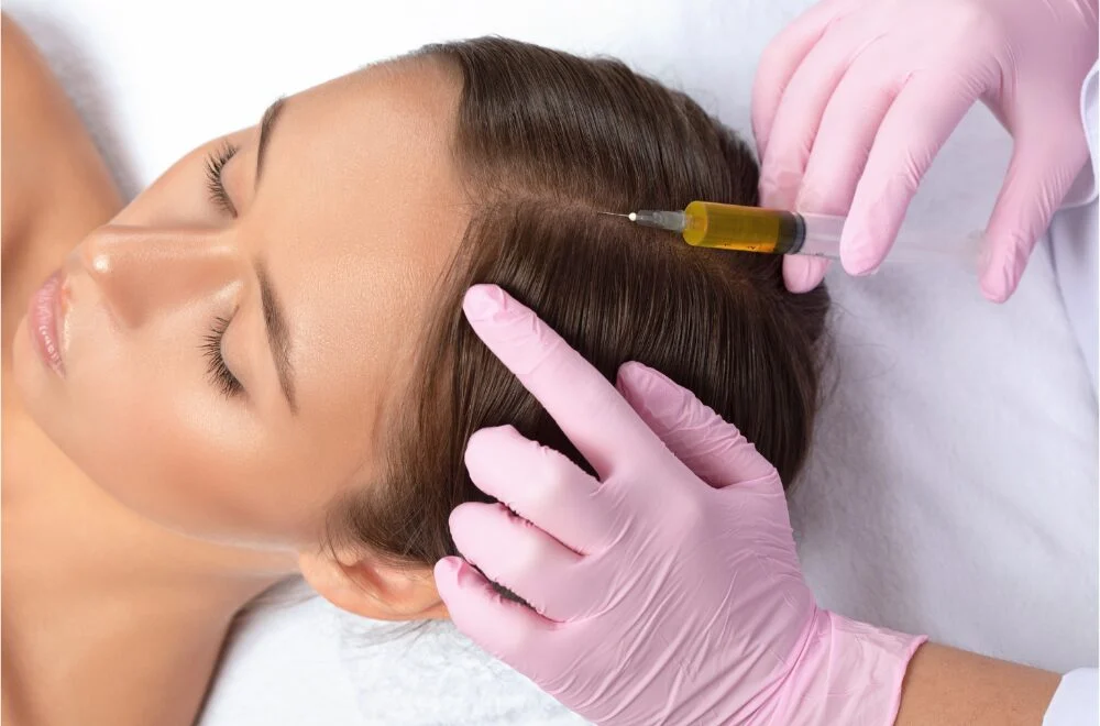 Benefits of PRP for Hair Restoration