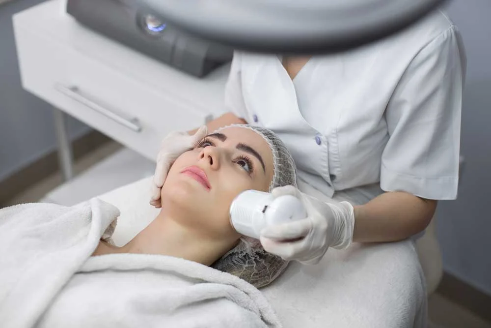 Before And After Result Of IPL Photofacial In Alamo CA