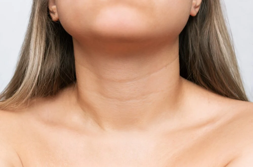 Is Kybella Fix Turkey Neck a Good Option for You