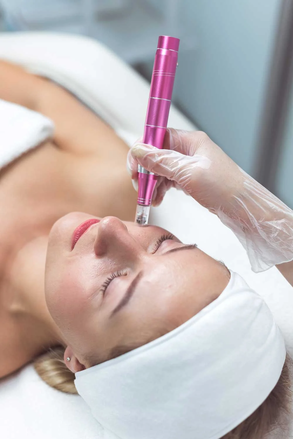 refresh-skin-with-prp-microneedling-alamo-ca