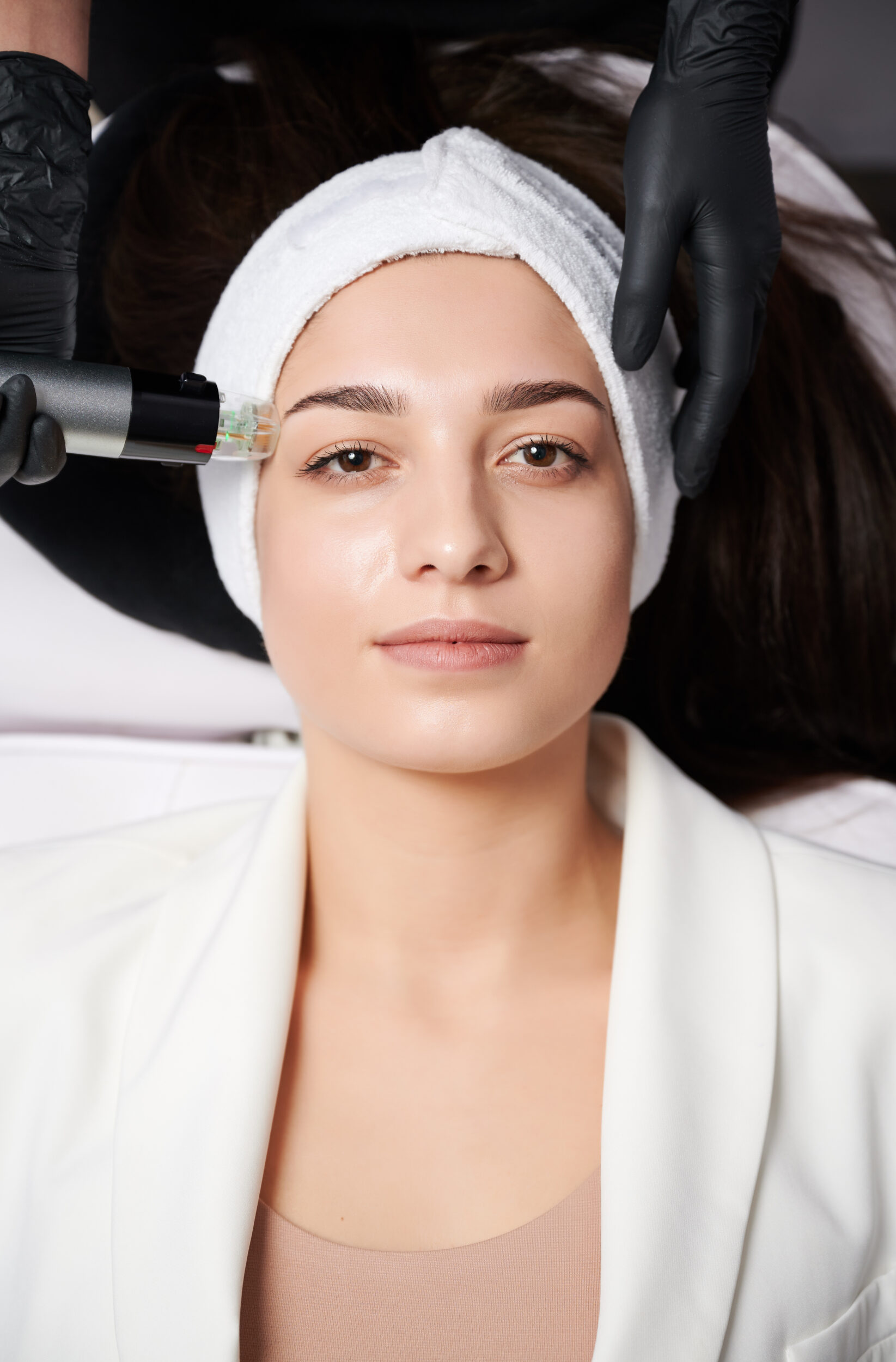 RF Microneedling for Wrinkle Reduction in Alamo CA