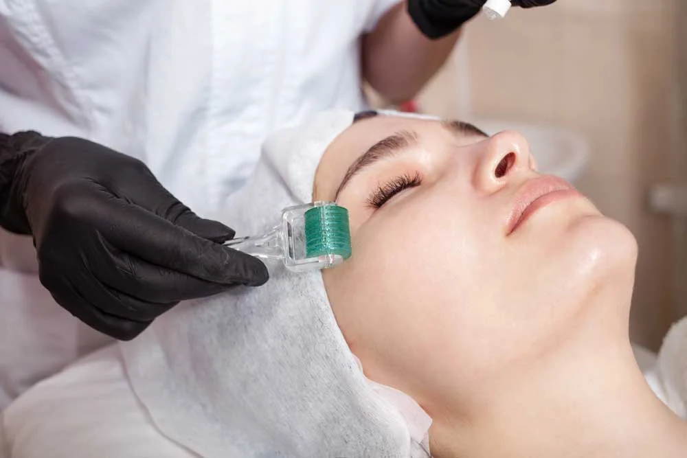 PRP Vampire Facial Treatment In Alamo CA