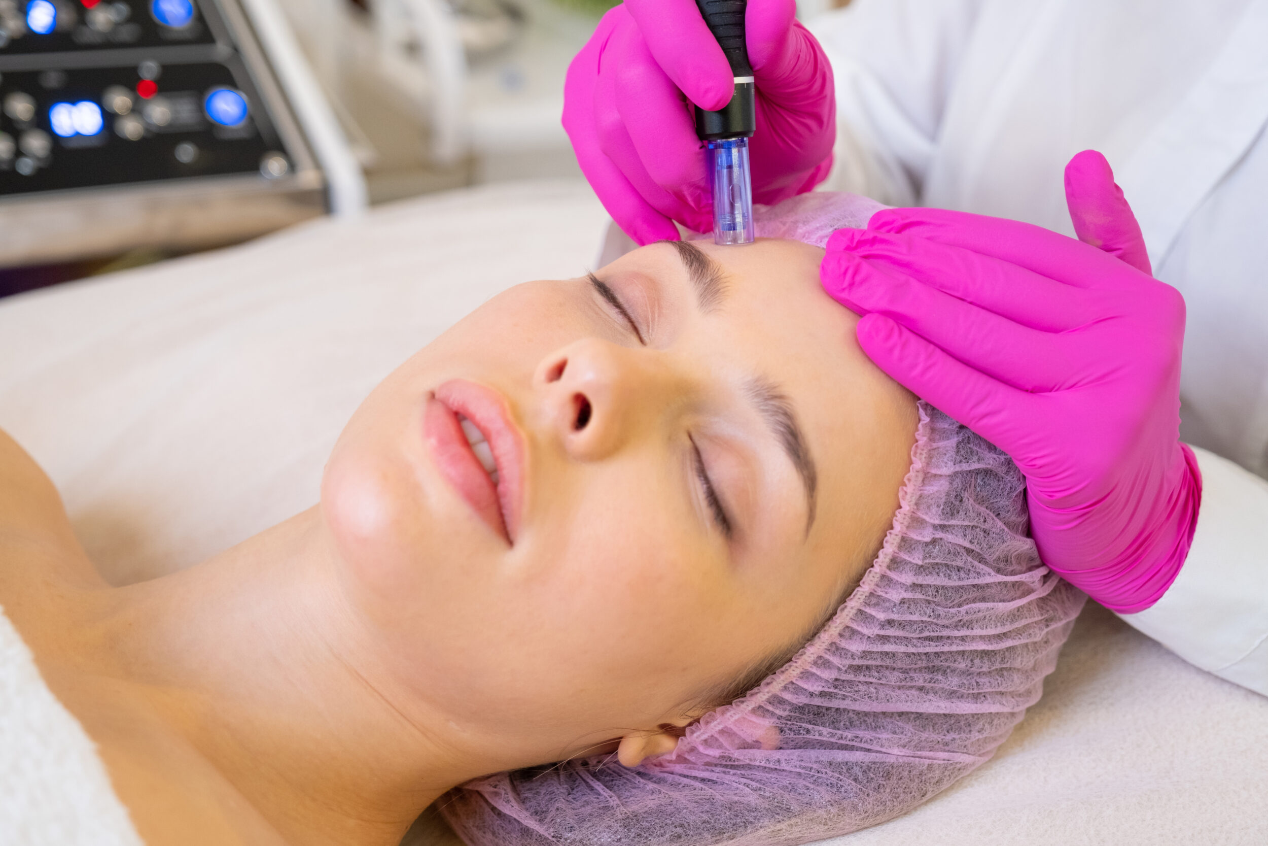 RF Skin Treatment at Skin Artistry in Alamo California