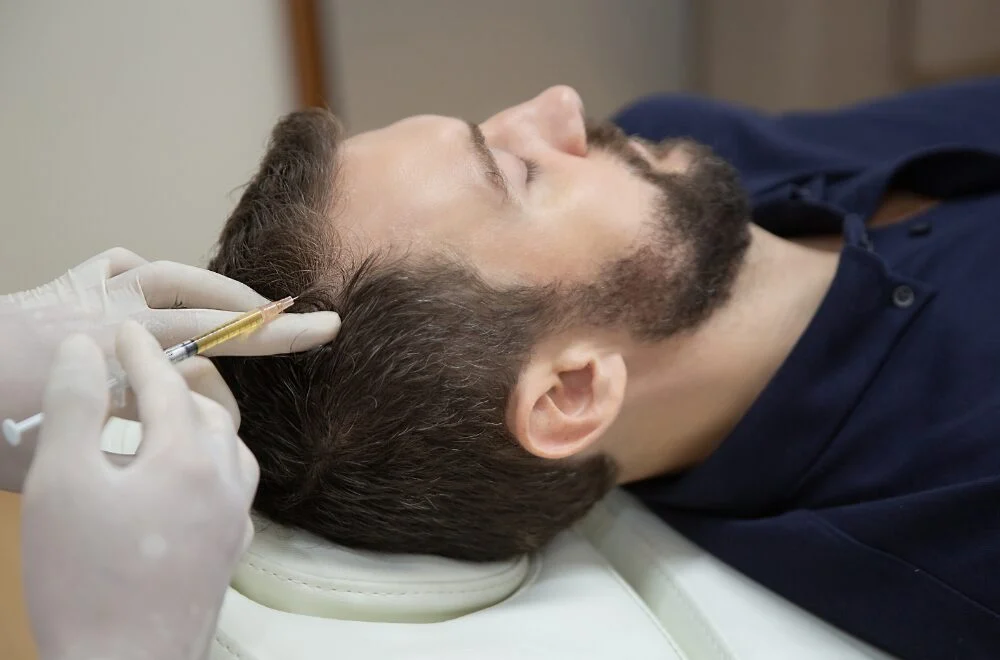 Platelet-Rich Plasma & Hair Loss