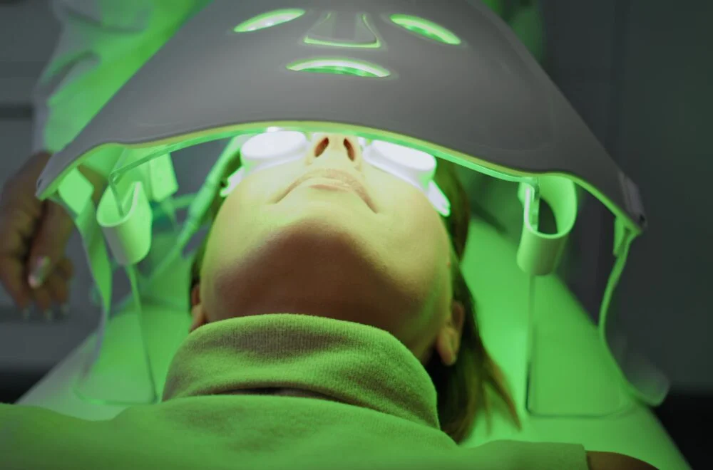Treating Redness & Scars With IPL