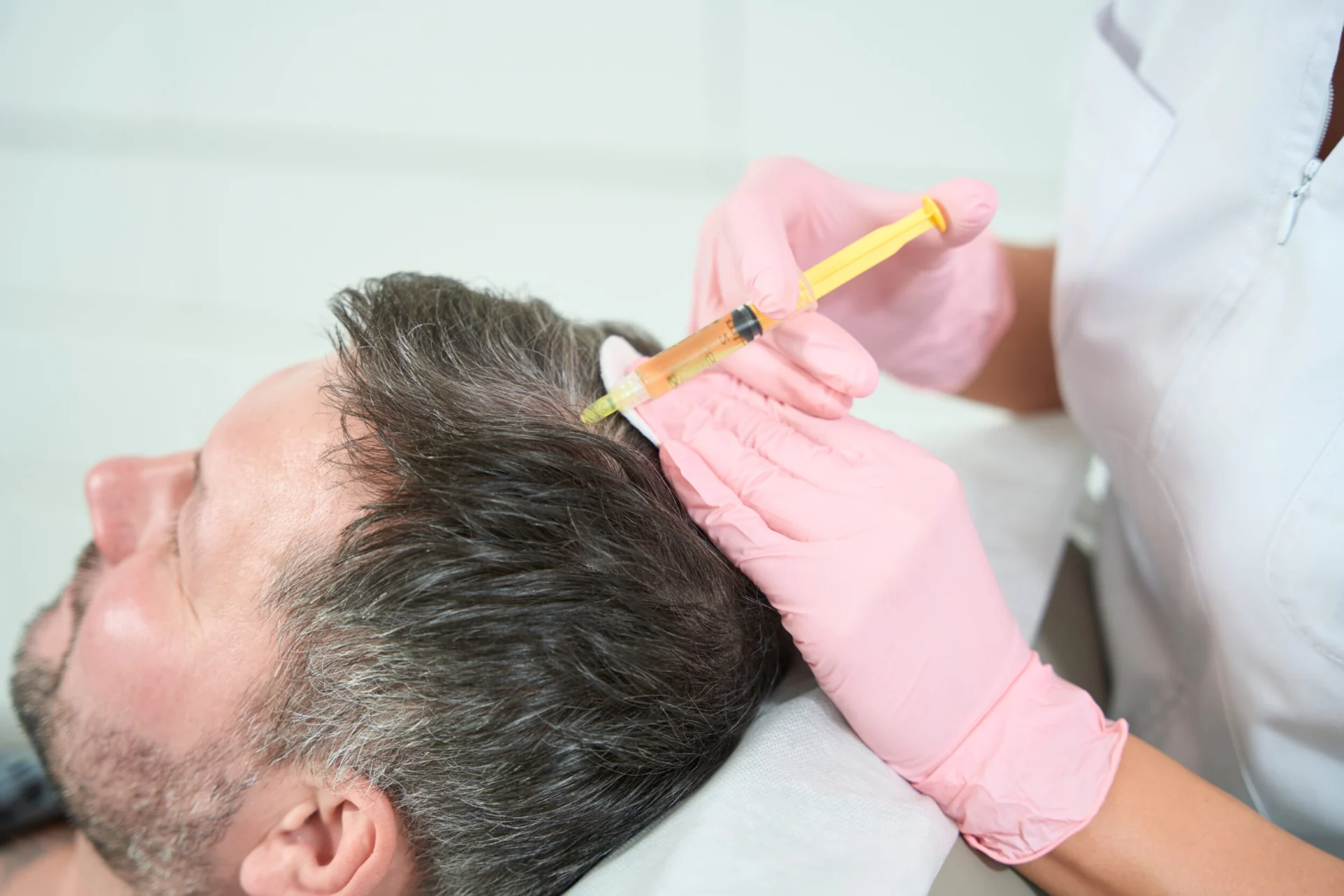 PRP Benefits Beyond Hair Growth