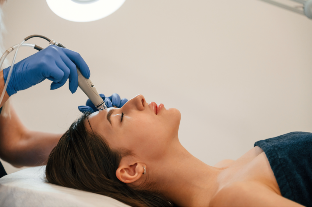 Treating Wrinkles With Microneedling