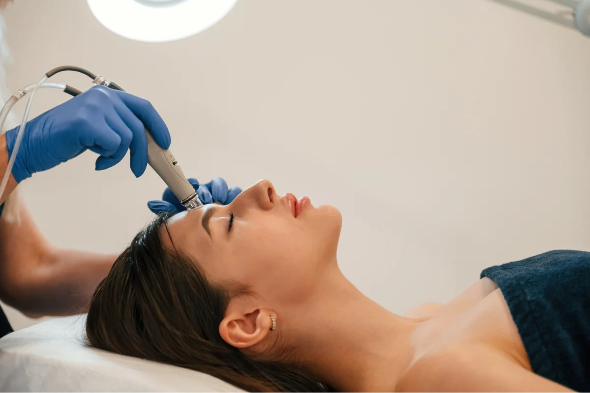 Treating Wrinkles With Microneedling
