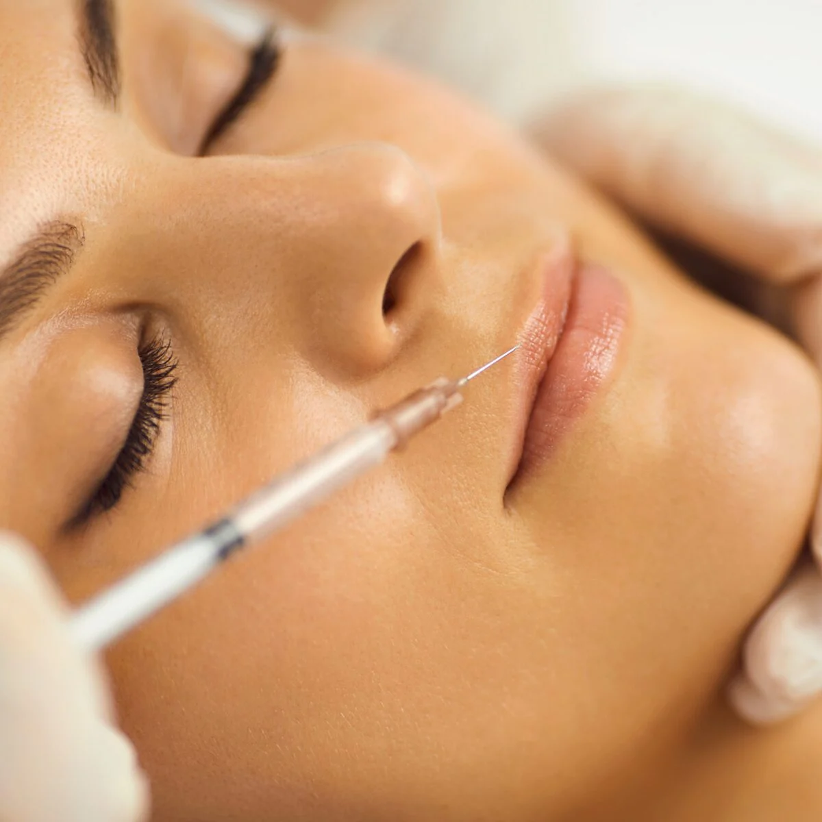 vampire facial skin artistry clinic