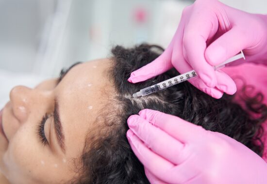 Do You Grow Hair After 1 Year Of PRP