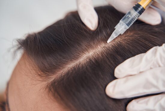 How Effective Is PRP For Hair Growth At Home