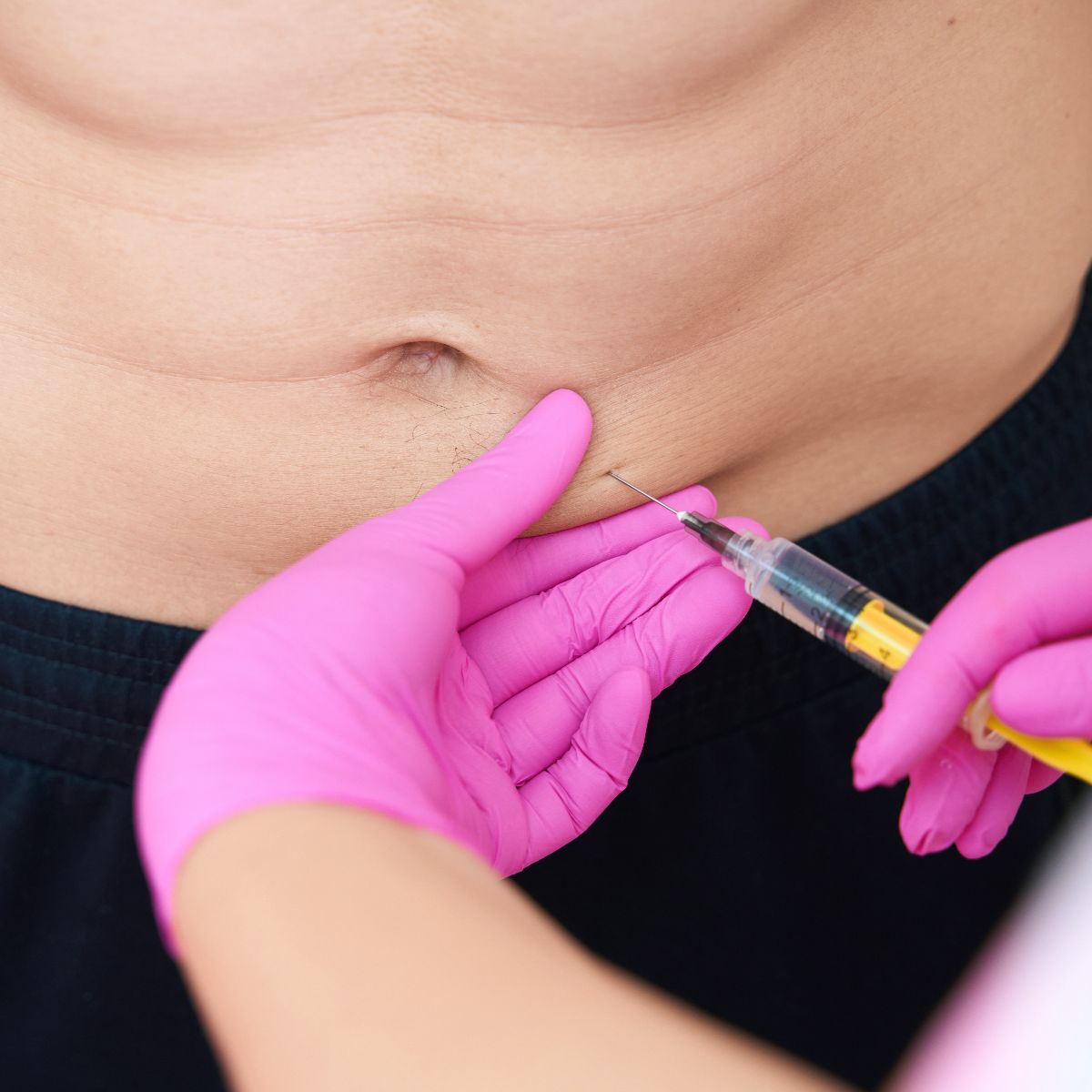 Kybella Injections For Stomach Fat & Love Handles