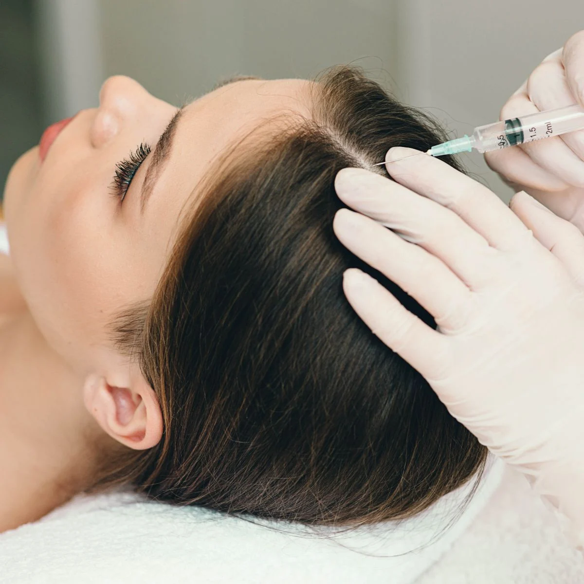 PRP Hair Treatment Price