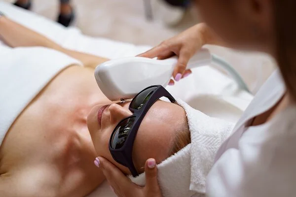 IPL Photo Facial Benefits