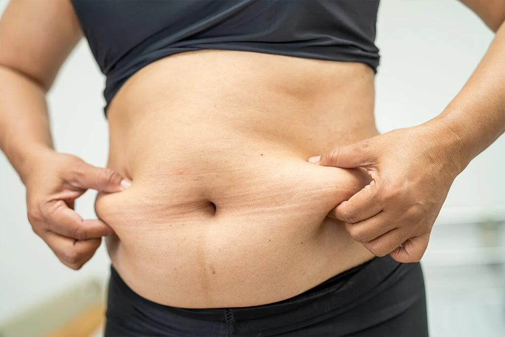 Can You Use Kybella On Belly Fat