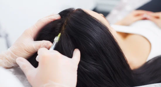 Does PRP Regrow Hair Permanently In Females