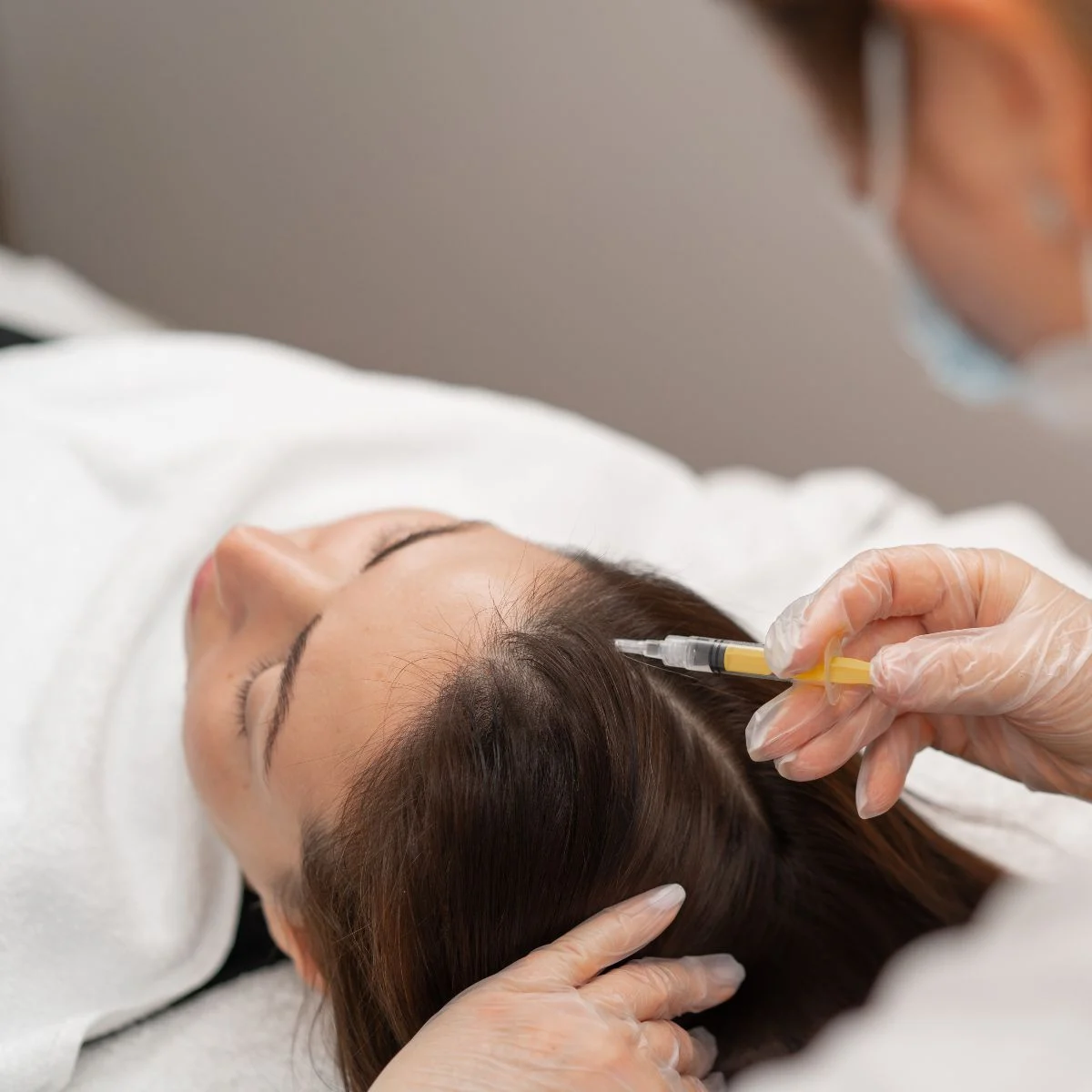 Benefits Of Microneedling With PRP