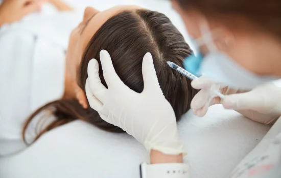 Best PRP Hair Treatment for Women