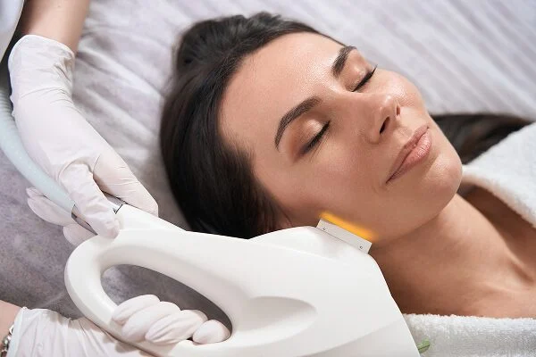 What Are the Benefits of an IPL Photofacial